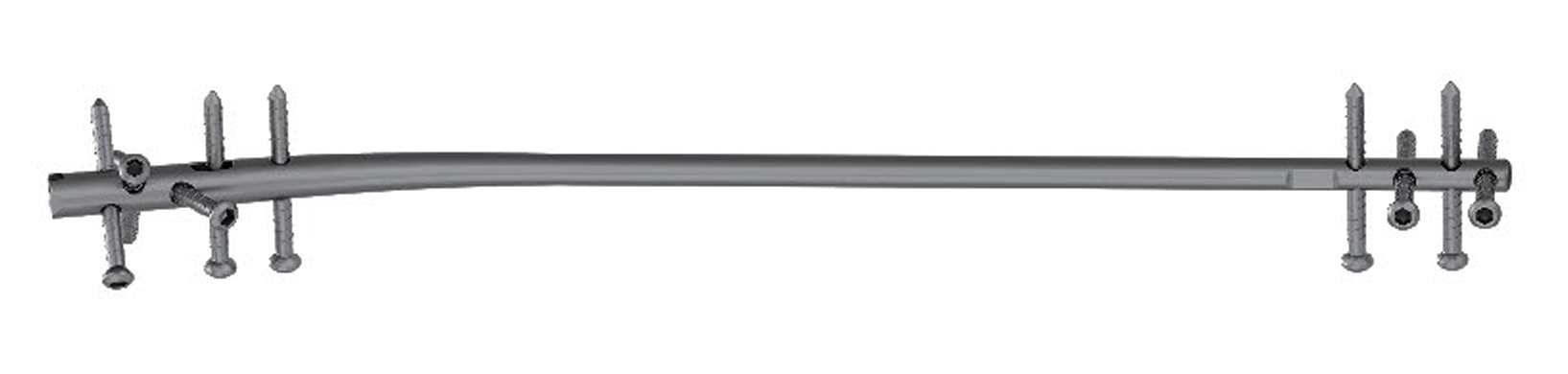 Блокуючий стержень для великогомілкової кістки UMP